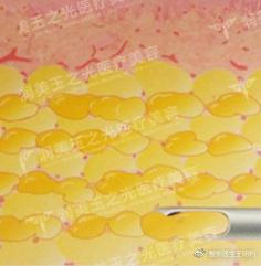 ����֬��